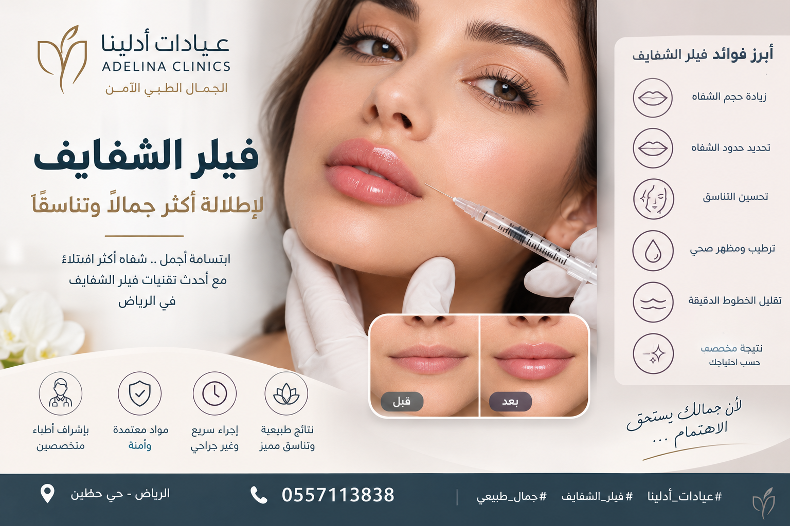 فيلر الشفايف في الرياض | الأنواع والأسعار والنتائج